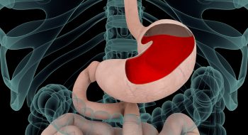 Illustration exploring acid reflux.