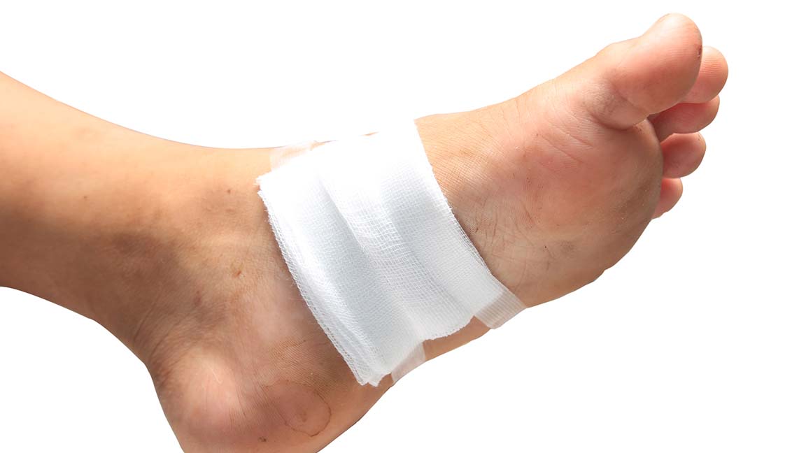 Gauze covers a foot ulcer