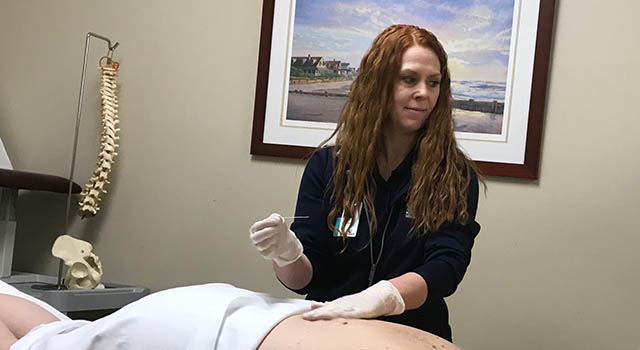 Kristin Dorio, a senior physical therapist at Tidelands Health Rehabilitation Services at Murrells Inlet, performs dry needling on Johanna Gersten. The therapy has been "incredibly beneficial," Gersten says.