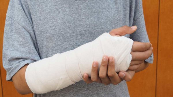 Broken arm in cast