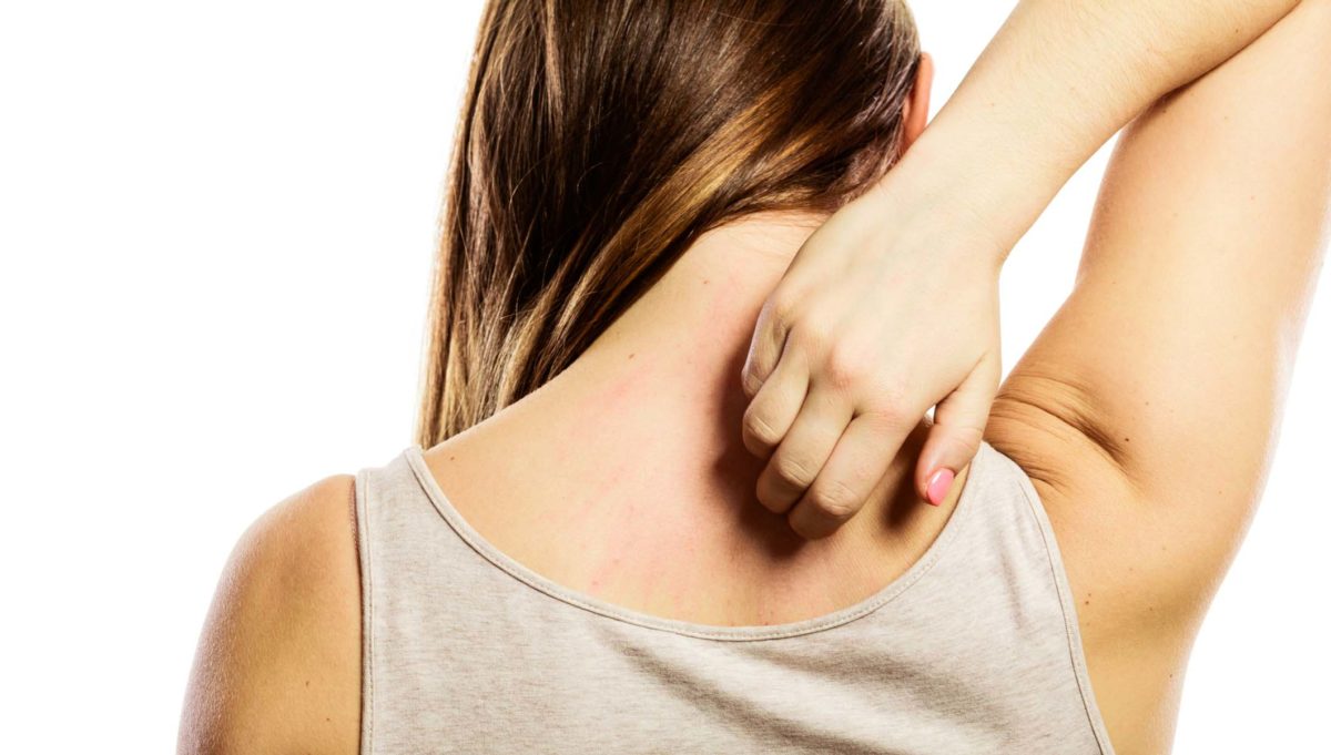 Woman scratching itchy back