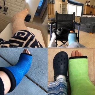 After tendon surgery in March, Pizzo has gone through through three casts, a boot and physical therapy on her path toward recovery.