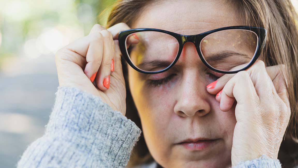 Woman rubbing itchy eyes