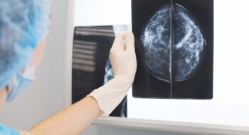 Nurse holding mammogram