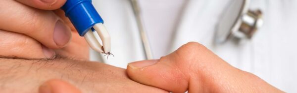 Female physician removing tick.