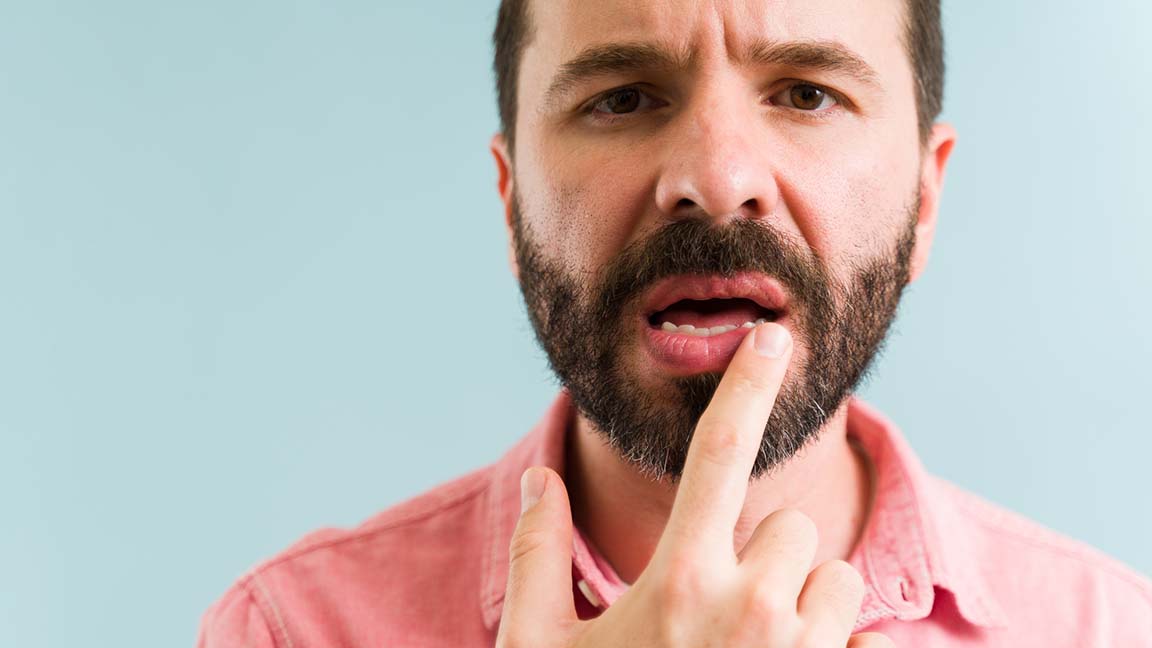 Man struggling with chapped lips.