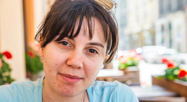 Woman with acne