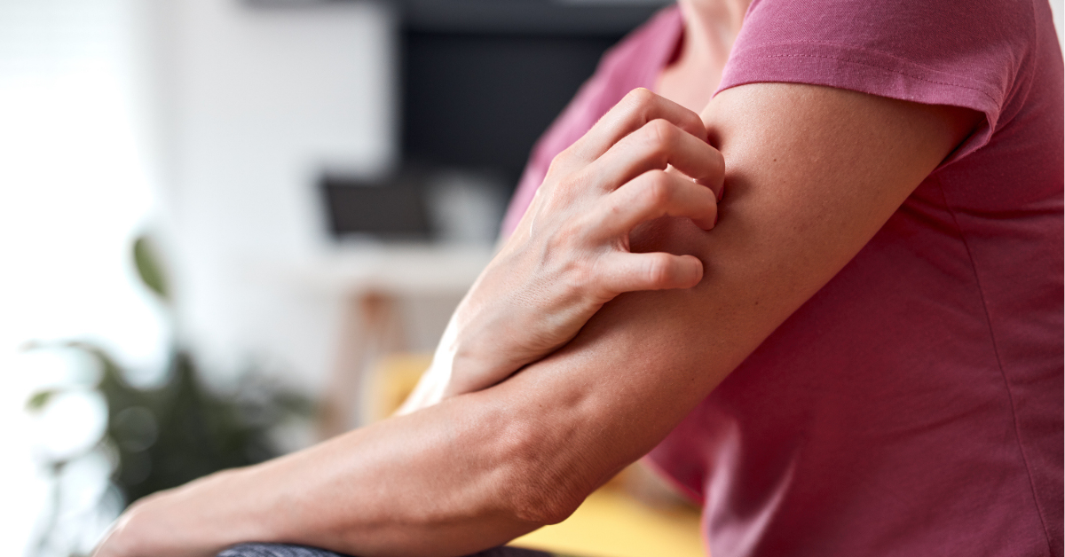 Woman with itchy, tingling arms scratching skin.