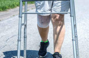 A real person, real life recent knee replacement surgery patient senior adult woman is doing her prescribed physical therapy. For safety and support, she uses an orthopedic mobility walker to walk slowly and carefully for increasing daily distances on the quiet streets around her suburban home. The open mesh bandage around her right knee protects and supports the surgical site wound and stitches while allowing constant fresh air to help the healing process.