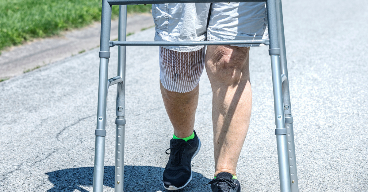 A real person, real life recent knee replacement surgery patient senior adult woman is doing her prescribed physical therapy. For safety and support, she uses an orthopedic mobility walker to walk slowly and carefully for increasing daily distances on the quiet streets around her suburban home. The open mesh bandage around her right knee protects and supports the surgical site wound and stitches while allowing constant fresh air to help the healing process.